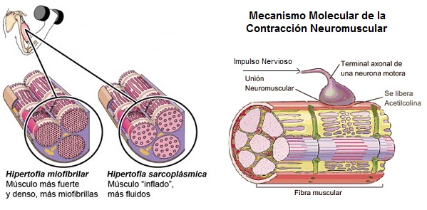 Hipertrofia