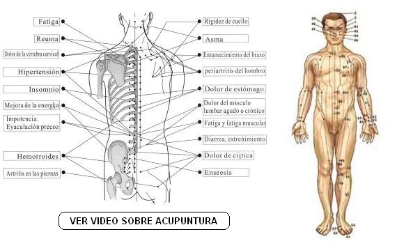 Acupuntura