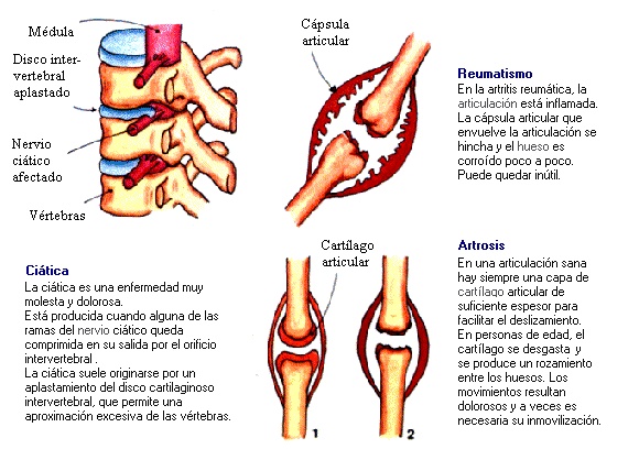 Articulaciones