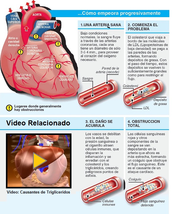 Corazón